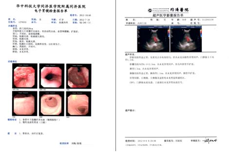 mha-pb5醫(yī)用打印膠片