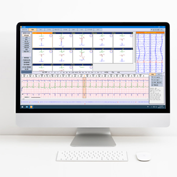 cardiosmart心電工作站軟件