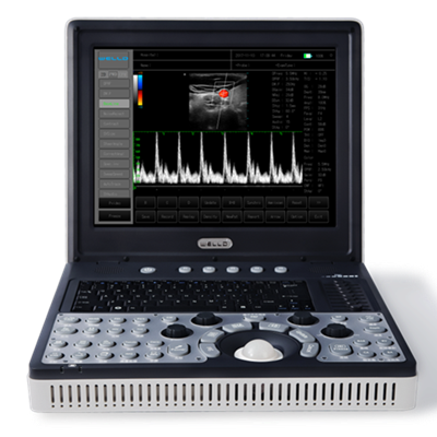d3便攜式全數(shù)字彩色多普勒超聲診斷系統(tǒng)
