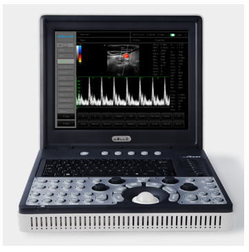 便攜式全數(shù)字彩色多普勒超聲診斷系統(tǒng)d3.