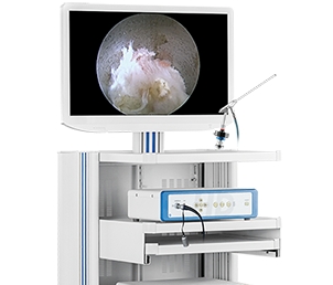 冠龍醫(yī)用內(nèi)窺鏡攝像系統(tǒng)ys-i